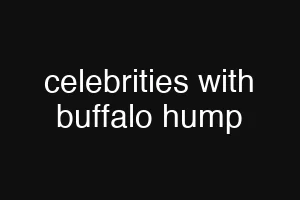 celebrities with buffalo hump